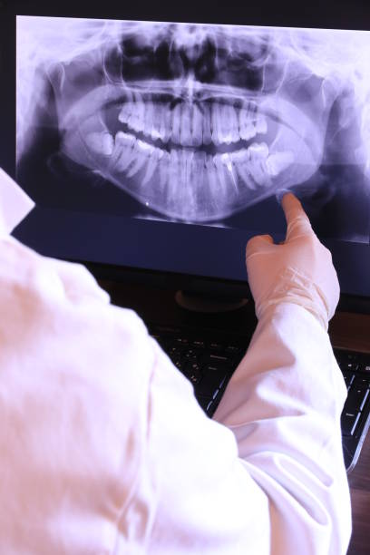 Best Emergency Tooth Extraction in August, CA